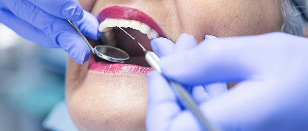 Best Emergency Treatment for Dental Infections or Abscesses in Orting, WA